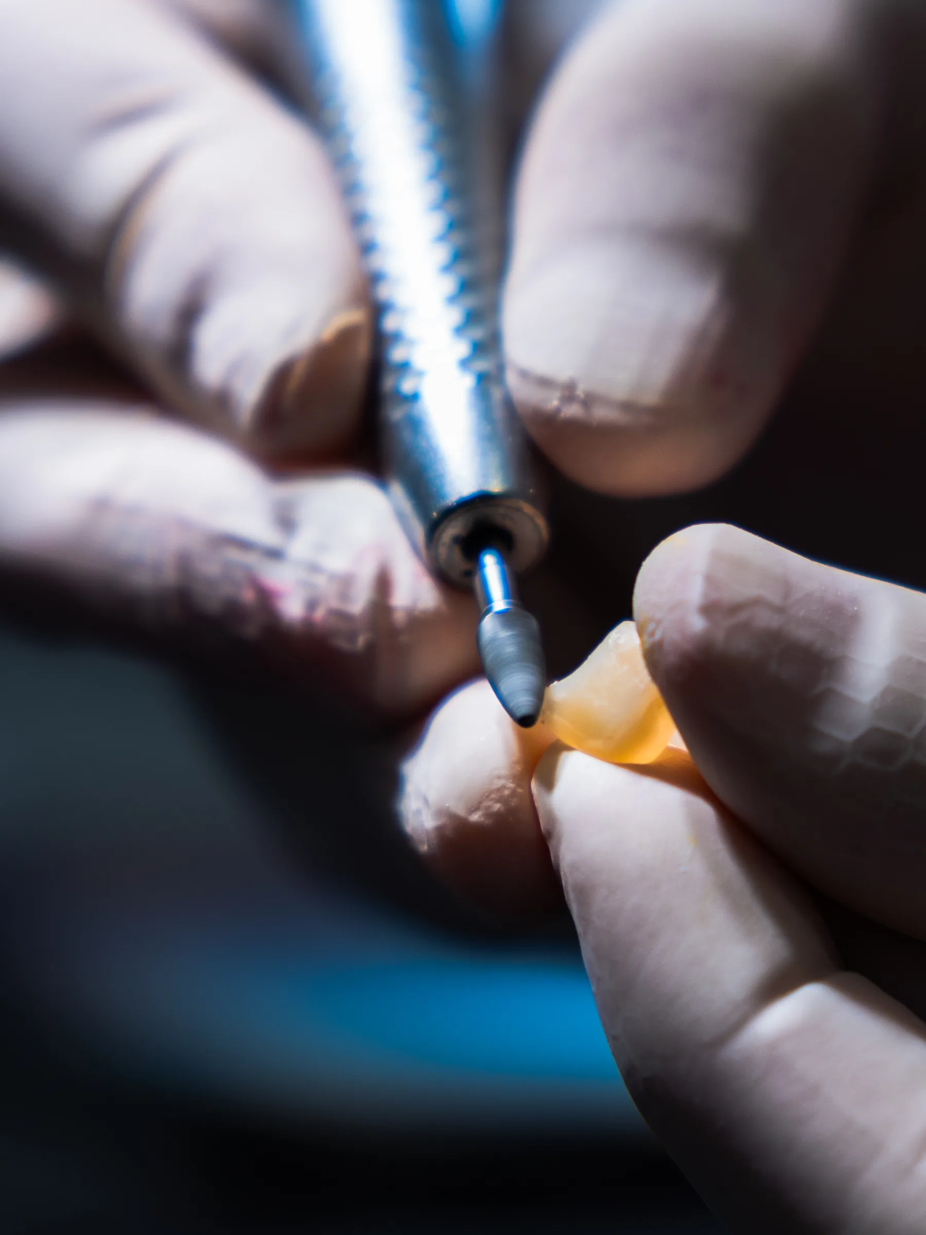 Macro di mani guantate che montano un impianto dentale con il cacciavite dinamometrico