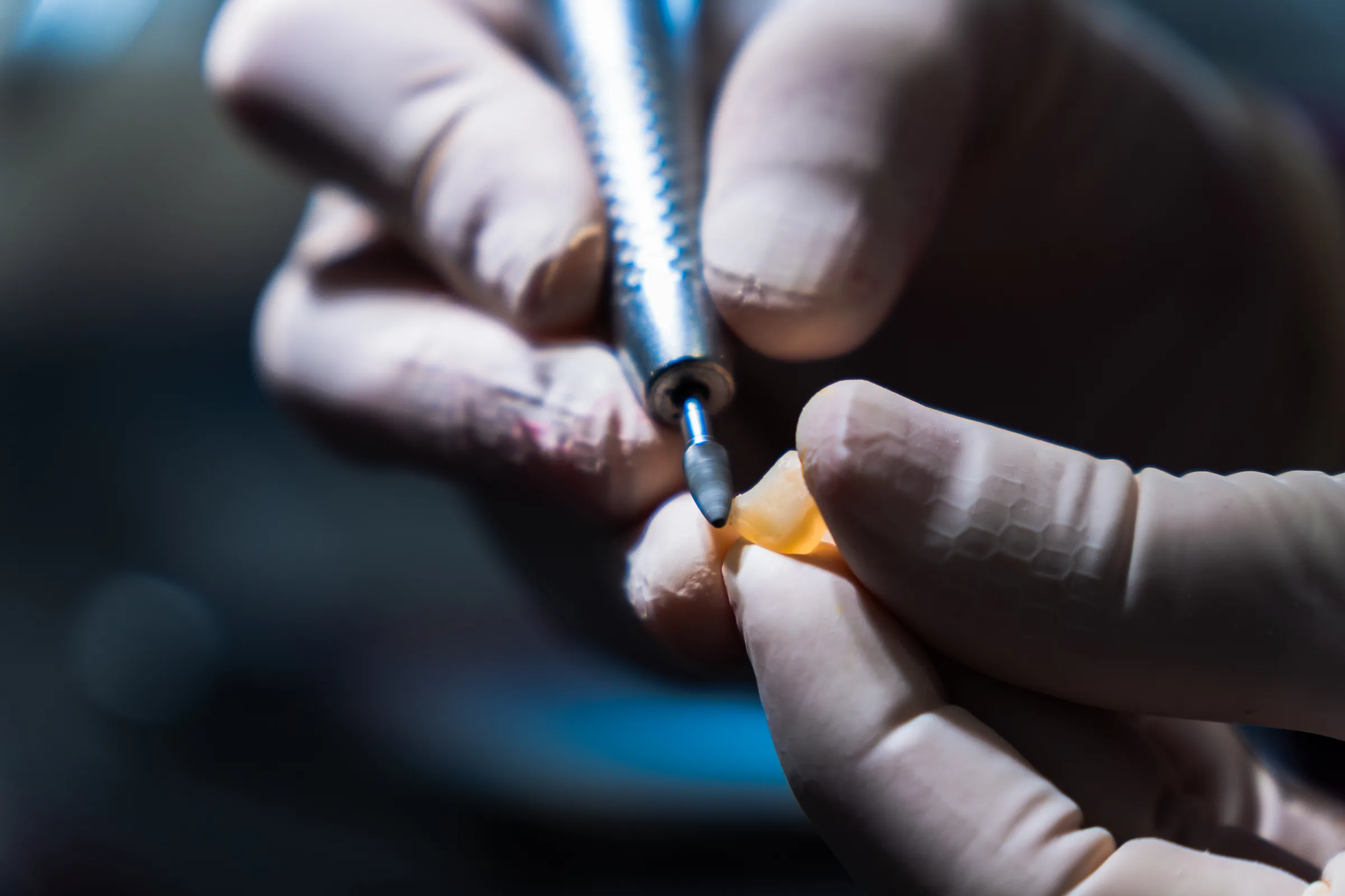 Macro di mani guantate che montano un impianto dentale con il cacciavite dinamometrico